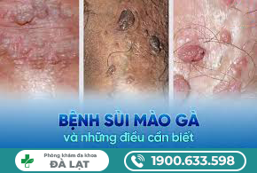 Hình ảnh minh họa